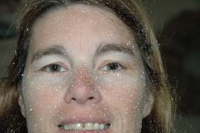 a very rare
                disease..caused by too much mud!